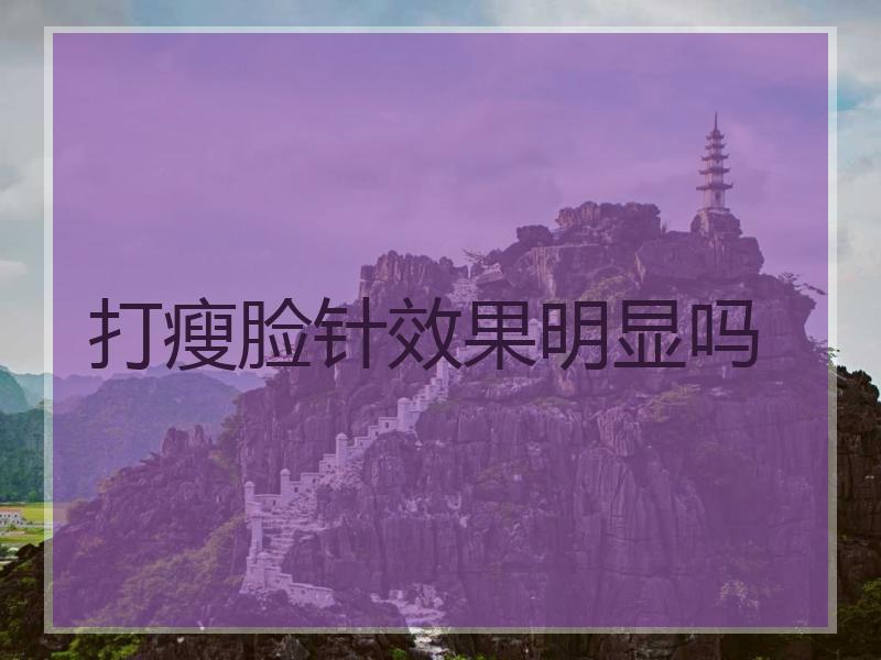 打瘦脸针效果明显吗
